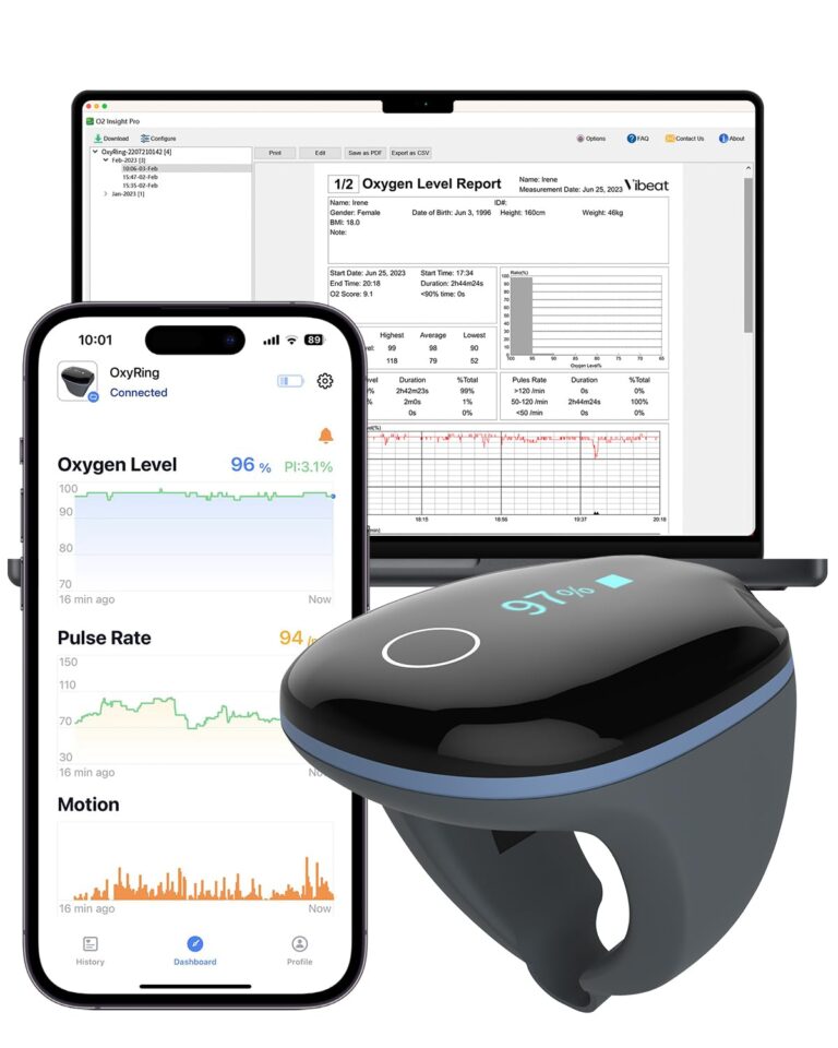Vibeat OxyRing Continuous Oxygen Monitor - Bluetooth Pulse Oximeter with Real-time Reminder & Free PC Report, Wearable Finger Oxygen Meter for 16hrs Oxygen Level & Heart Rate Recording