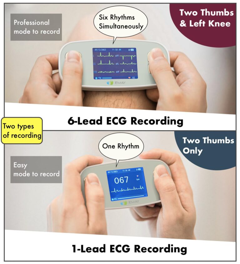 EMAY 6L Portable ECG Monitor | Record ECG and Heart Rate in 6 Channels | Compatible with Smartphone and PC | No Subscription Required - Image 6