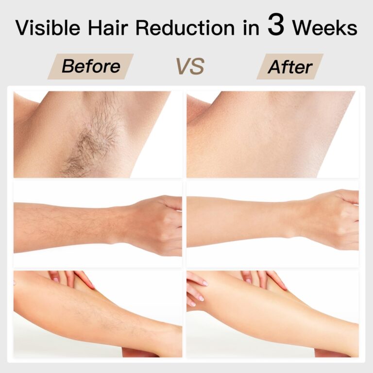 Laser Hair Removal, BoSidin IPL Hair Removal with Painless Ice-Cooling, 2-in-1 Face SR Rejuvenation, 6+1 Modes, 6 Levels Hair Removal for Women Permanent, Laser Hair Removal Kit with Shaver, Goggles - Image 7